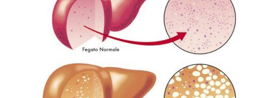 Fegato e metabolismo degli zuccheri